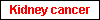 Kidney cancer
