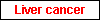 Liver cancer