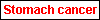 Stomach cancer